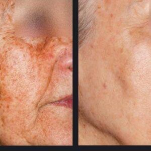 Nordlys Light and Bright Treatment