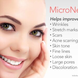 Microneedling